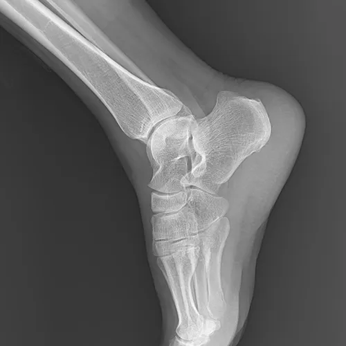 Radiografía de Extremidades