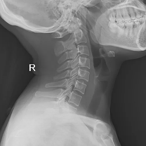 Radiografía Craneal