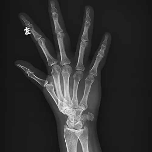 Radiografía de Extremidades