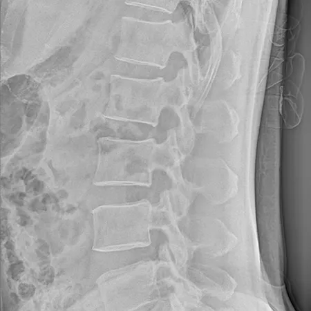 Radiografía de la Columna Vertebral