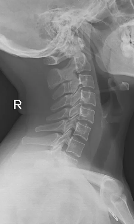 Radiografía Craneal
