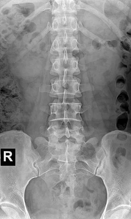 Radiografía Abdominal